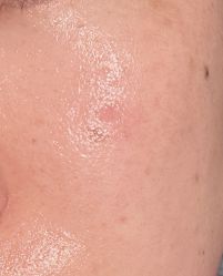 体验后-南京医科大学友谊整形外科医院