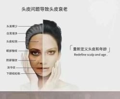 -诗碧曼养发