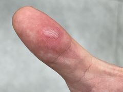 -冯鱼头火锅(青蓝山美食一条街店)