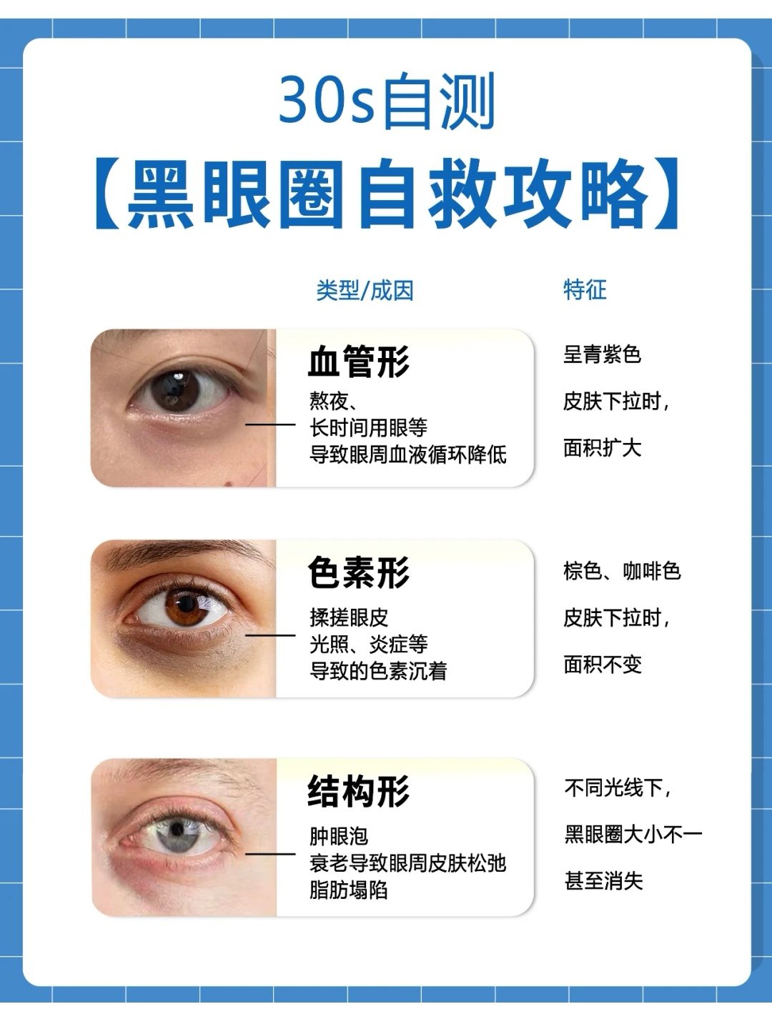 各种类型的黑眼圈图片图片