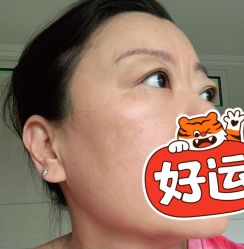 体验后-华臣医疗美容