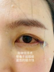体验后-八大处整形