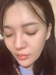 -More摩尔医美の注射线雕光电中心