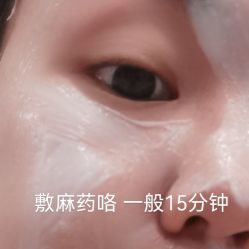 体验前-杭州米兰柏羽医疗美容医院