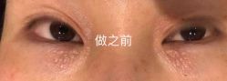 -美丽人生祛斑扁平疣汗管瘤中心