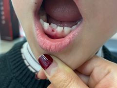 -牙博士口腔品牌连锁(杨浦店)