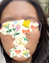 体验后-SKINIST丽铂医疗美容