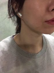 体验后-北京丽星翼美医疗美容