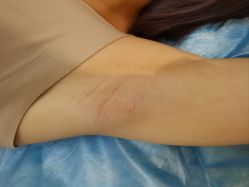 -南宁华美医疗美容医院