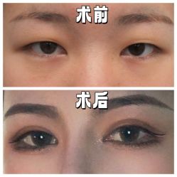 -素美医疗美容·西南眼鼻整形·修复基地