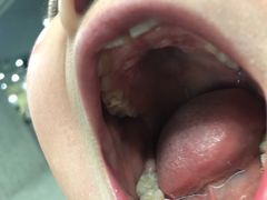 -武汉大学人民医院(首义院区)