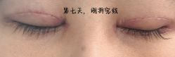 -JustHer宁波珈禾医疗美容医院