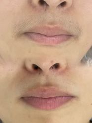 -美愈美肤MEIYU SKIN