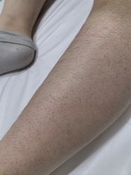 体验前-上海首尔丽格医疗美容医院