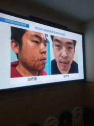 -成都军建医院·疤痕诊疗中心