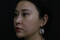 -深圳春天阳光医院·轮廓抗衰中心