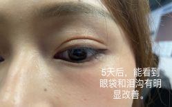 体验后-安徽合肥韩美整形外科医院
