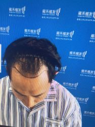 -雍禾植发全国连锁