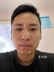 体验前-上海锦妍医疗美容门诊部