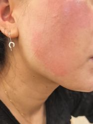 -长沙雅美医疗美容医院