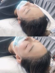 -西施无菌半永久纹绣眉眼影唇轻增发纹发际线