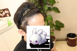 -大麦微针植发丨全国连锁