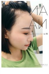 点击看大图 -大麦微针植发全国连锁