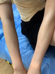 体验后-广州美莱医疗美容医院