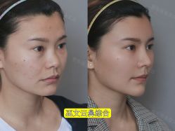 -北京米扬丽格医疗美容·联合丽格鼻整形中心