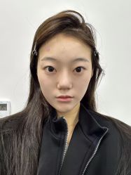 -成都西区医院整形美容