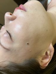-清疣美疣·痣·斑净肤中心