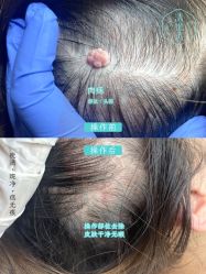 -清疣美疣·痣·斑净肤中心