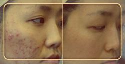 -SKINIST丽铂医疗美容