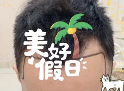 -大麦微针植发全国连锁