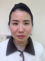-Yestar杭州艺星医疗美容医院