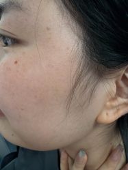-长沙雅美医疗美容医院
