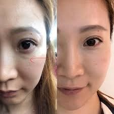 点击看大图 -SKINIST丽铂医疗美容