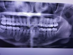 -土豆口腔(凤凰北总店)