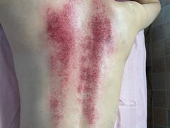 -沈师傅盲人按摩工作室(密三小区店)