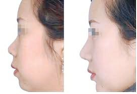 -SKINIST丽铂医疗美容