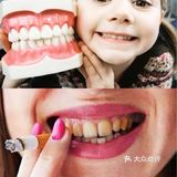 牙齿随着年龄越来越黄 该怎么美白牙齿呢？