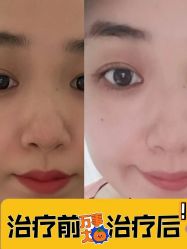 -杭州米兰柏羽医疗美容医院