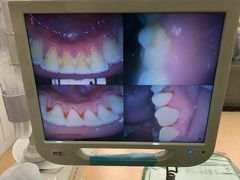 -赫尔森口腔·牙齿种植修复