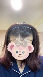 体验前-熙朵美学植发·连锁品牌