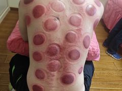 -沈师傅盲人按摩工作室(密三小区店)