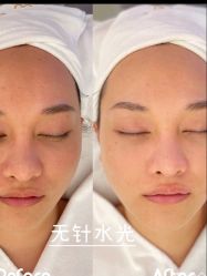 -BiuBiu Beauty·肌肤管理