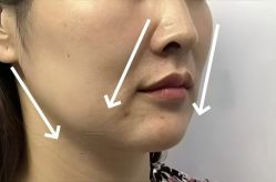 -上海伊莱美医疗美容医院