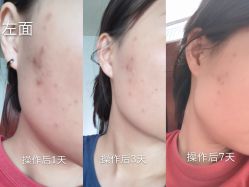 点击看大图 -瑾秀美肤·问题肌修护