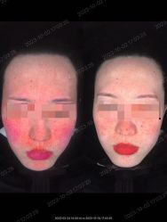 -LUNA皮相美·骨相美高级美感