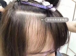 -AD HAIR 
